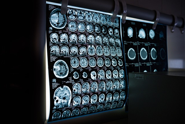 MRI Images of the Brain